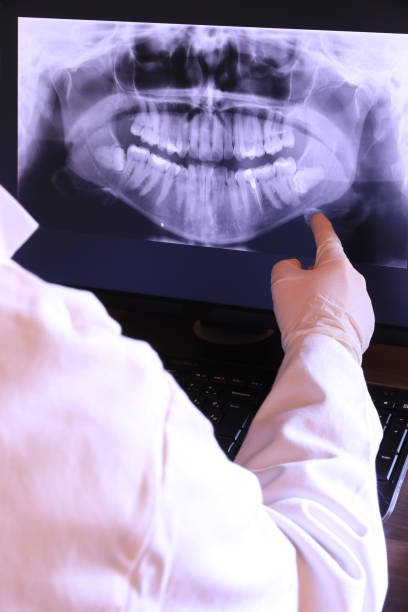 Best Emergency Dentist for Knocked-Out Tooth in Nanakuli, HI